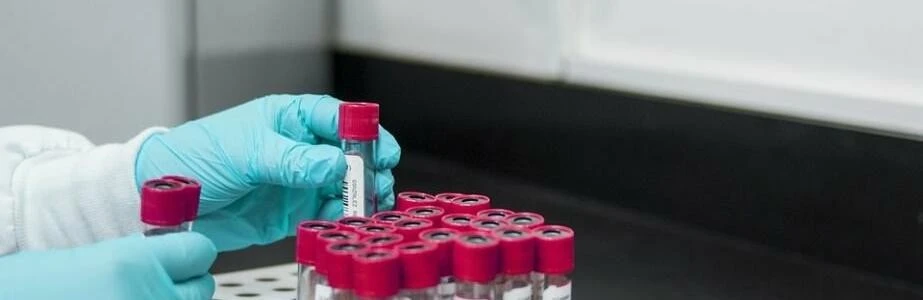 На Полтавщині за тиждень зафіксували 67 випадків кишкових інфекцій