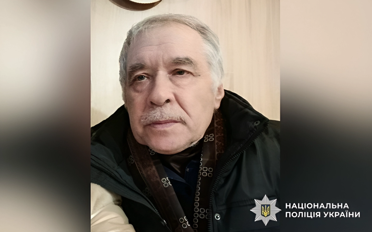 Ранні сигнали меланоми: на що звернути увагу